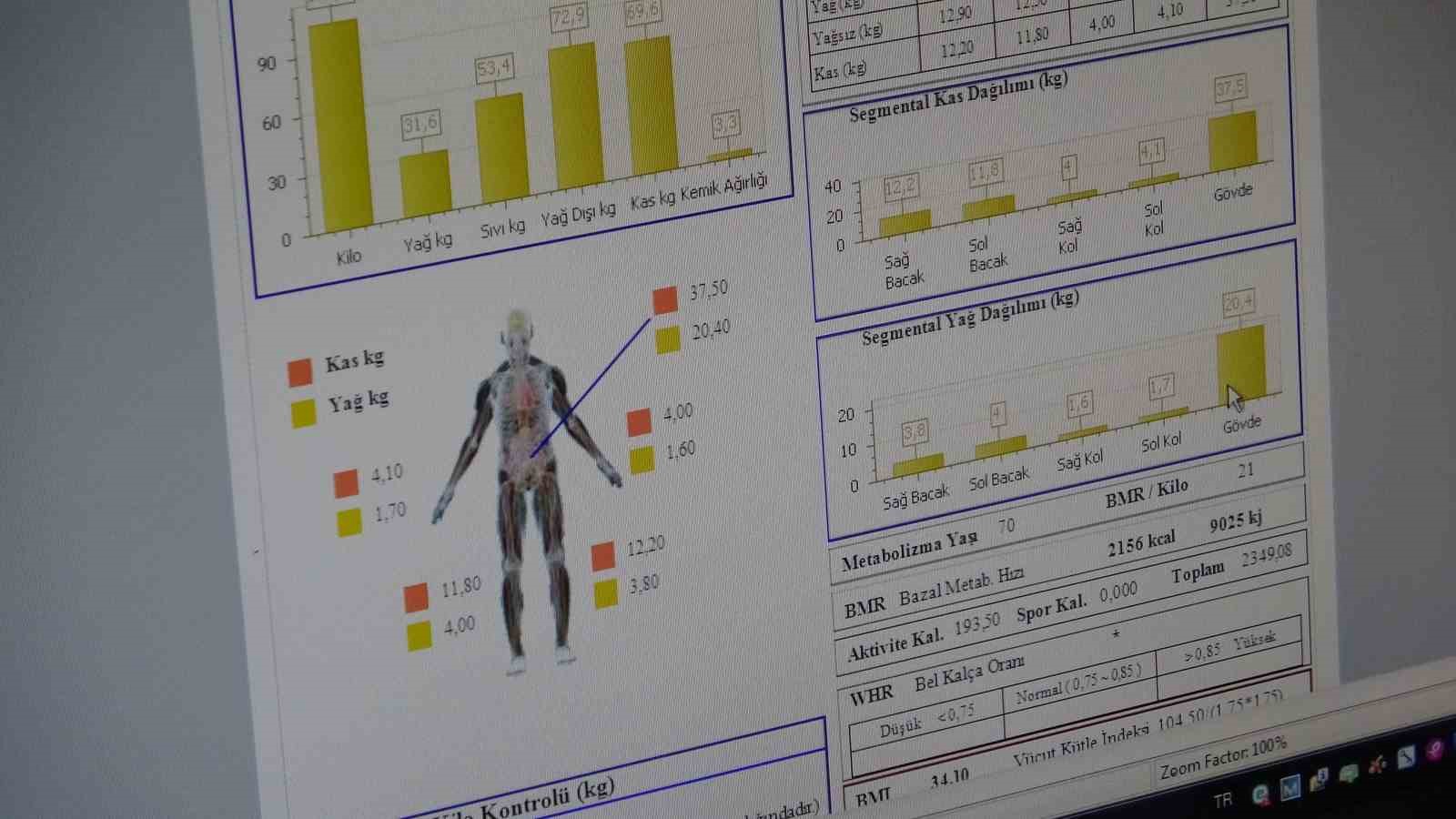 Van’daki obezite merkezi yılda 1 ton kilo verdirdi