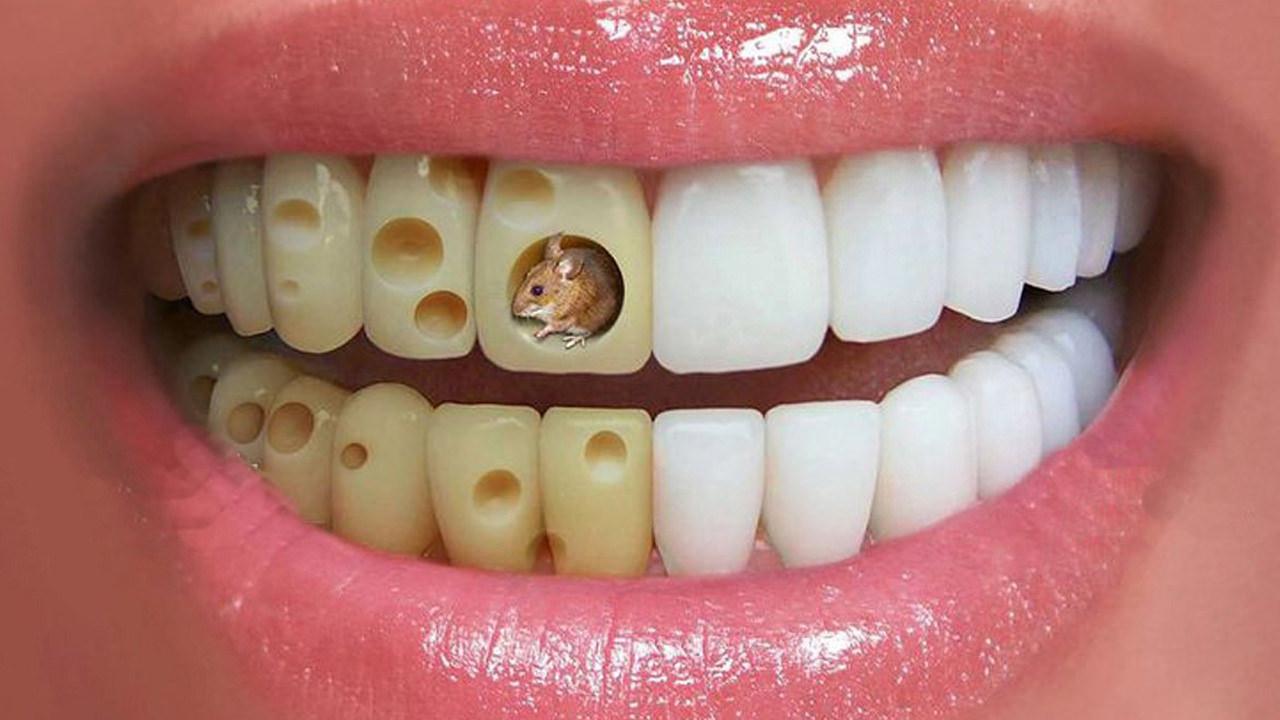 Çay yüzünden sararan dişlere çözüm: Diş lekeleri nasıl geçer?