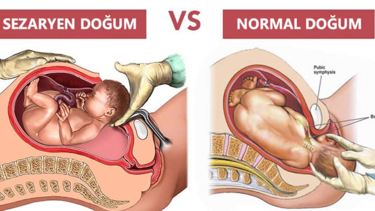 Normal doğumun 10 maddede sağlığa faydaları: Normal doğumun anneye faydaları