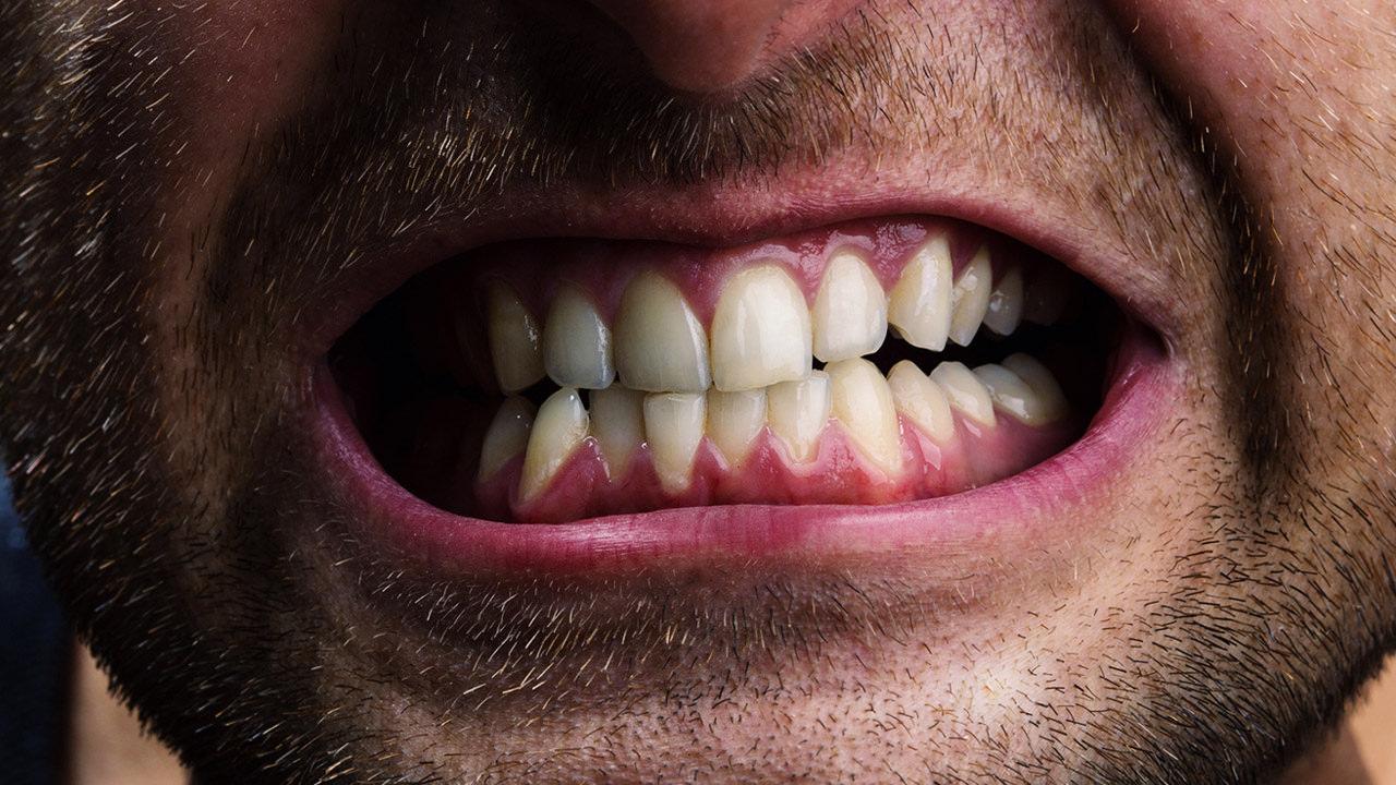 Dişlerinizi sıkıyorsanız aman dikkat! Diş gıcırdatmak tam 20 yaş daha erken yaşlandırabilir…